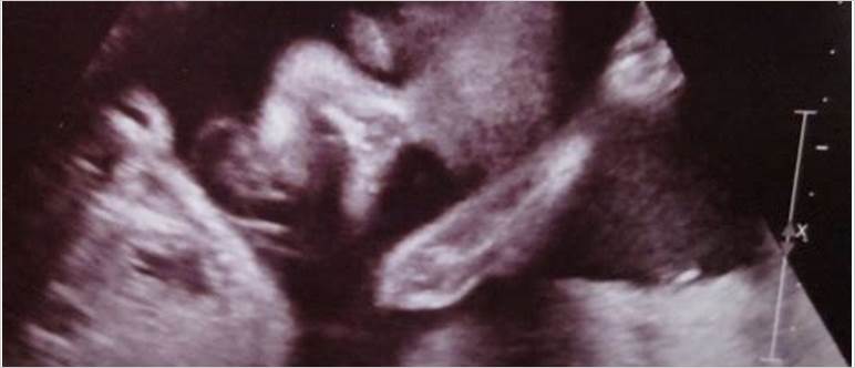 27 week ultrasound face